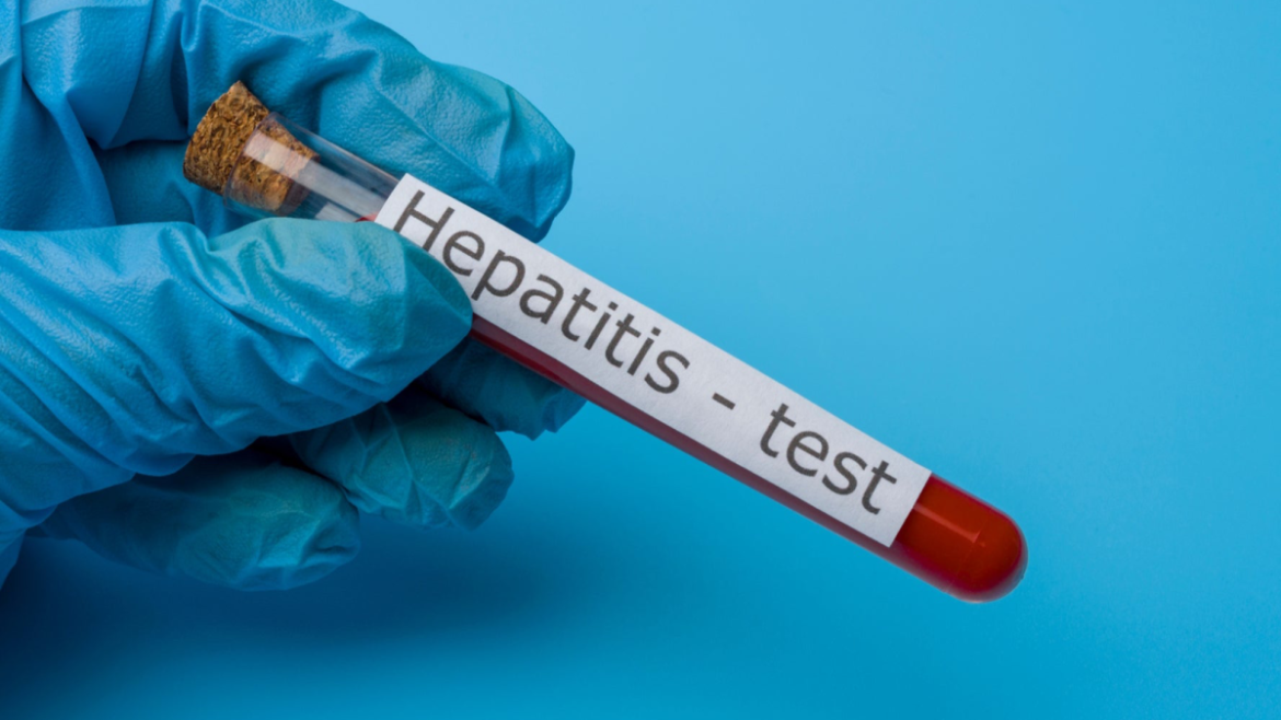 OMS alerta que la hepatitis sigue aumentando su mortalidad en el mundo